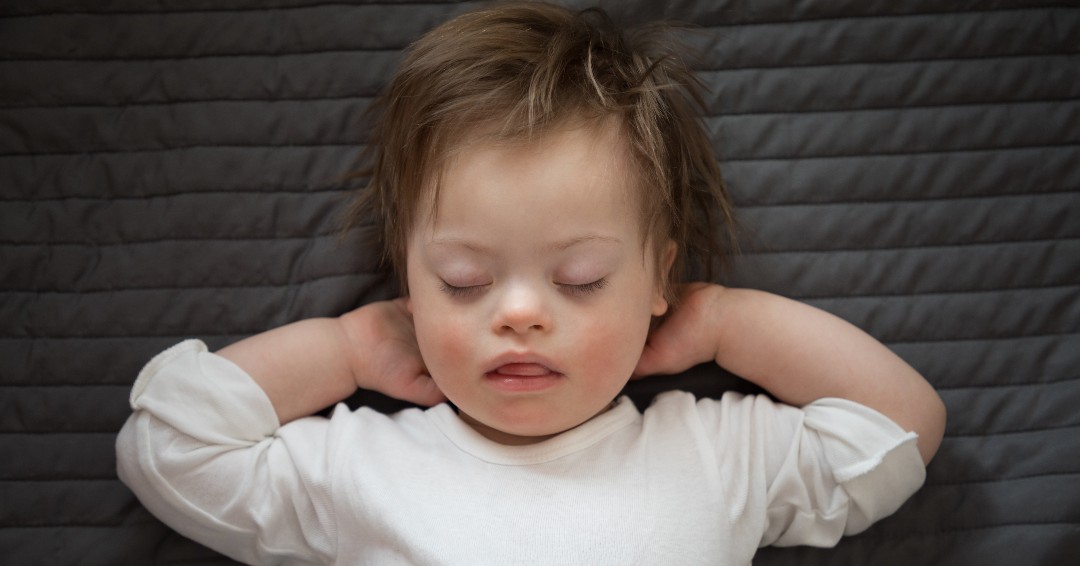 Child with down syndrome sleeping